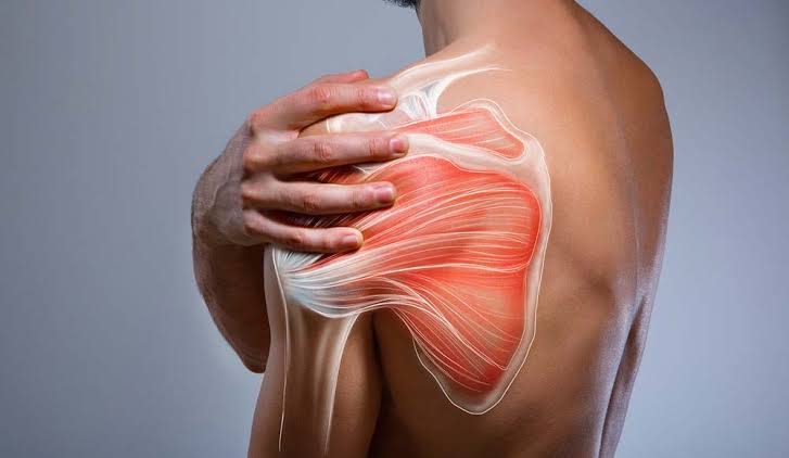 Dolor en la Parte Posterior del Hombro: 7 Claves Útiles