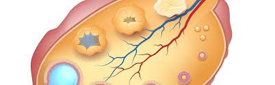 We are, of course, talking about ivf with donor eggs. What Is A Follicle And How Many Follicles Do You Need Ivi Fertility