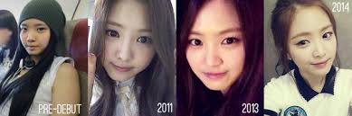 A pink son naeun, more plastic surgery rumors after namjoo. I Read In The Search Engine When I Type The Word Apink I Find That Apink S Naeun Have Plastic Surgery On His Nose And Eunji And Chorong Performing Liposuction Is That True
