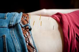 ® registered marks of blue cross blue shield of massachusetts. Medicare Now Covers Acupuncture The Martha S Vineyard Times