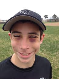 4PointsBaseball (@4pts_baseball)