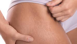 Vitamin E For Scars And Stretch Marks 100 Pure