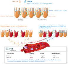 Sind immunglobuline im liquor erhöht, muss man daher auch das albumin beachten, um zu sehen, ob das immunoglobulin nicht einfach aus dem blut kommt, und nicht im liquorraum produziert wird. Nahrungsmittelunvertraglichkeit Leaky Gut Inflammatio Labor Diagnostik Und Fortbildungen Fur Arzte