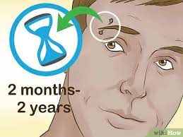 How To Avoid Eyebrow Piercing Scars With Pictures Wikihow