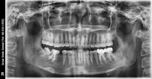Great Smile Dental Home Facebook