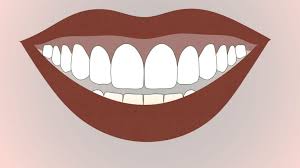 How To Fix A 'Wonky' Smile - Dr Gurs Sehmi