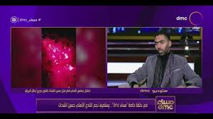 وهو يعني لاجل هذا الحديث ذهبوا إلى القول بالحرمة ونحن لا نرى أن هذه الحجة كافية في إثبات حكم شرعي وخصوصاً في الحلال والحرام. Dmc Tv ØªØ¹Ù„ÙŠÙ‚ Ø­Ø³ÙŠÙ† Ø§Ù„Ø´Ø­Ø§Øª Ø¹Ù„Ù‰ ÙÙŠØ¯ÙŠÙˆ Ø¥Ù‡Ø§Ù†Ø© Ø§Ù„Ø¬Ù…Ø§Ù‡ÙŠØ± Ù„Ø´ÙŠÙƒØ§Ø¨Ø§Ù„Ø§ Ù…Ø³Ø§Ø¡ Dmc Facebook