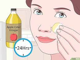 How To Remove Facial Warts Facial Warts Home Remedies For Warts Warts Remedy
