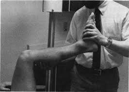 Image result for Ballottable Patella Sign