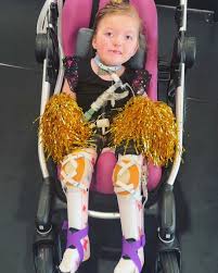 Exciting News! Rylee is getting her halo back on Friday, and ...