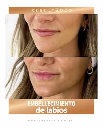 SUVANZA| Innovación y calidad(@suvanza) • Instagram写真と動画