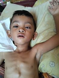 Tolong! Nyawa Anak Saya Bisa Terancam Apabila Tak Operasi Jantung Segera