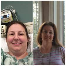 recovery after gastric sleeve surgery and breathing exercises