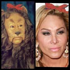 Emily face lift ? Filler? : r/rhoc