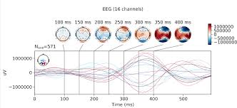 Lloyd table 1.3 >8% normalized only, eeg accessible. Event Related Potentials P300 Eeg Bci Dataset Ieee Dataport