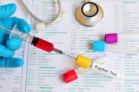 Intestinal Metaplasia Symptoms Causes Diagnosis And Treatment
