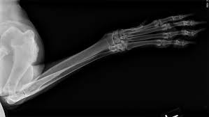 If your pet has rapid weight loss, is weak, starts to eat less, has vomiting or diarrhea, then it may be time to euthanize. Is Your Dog Limping Canine Bone Cancer May Be Part Of The Diagnosis Wjla
