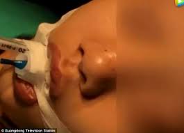 Walau bagaimanapun, beberapa penyelidik perubatan dan ahli kesihatan mengesyaki bahawa kuman yang hidup di dalam otak mungkin menjadi punca alzheimer. Hanya Kerana Picit Blackhead Budak 10 Tahun Ini Disahkan Terkena Jangkitan Kuman Di Otak Kisah Dunia