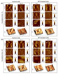 Ijms Free Full Text Antifungal Activity Of Anionic Defense Peptides Insight Into The Action Of Galleria Mellonella Anionic Peptide 2 Html