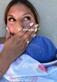 I Was Stung by A Bee