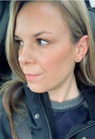 What does a bronzing complexion indicate if you have HH