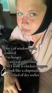 Wisdom Tooth Removal Recovery Day 3