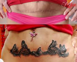 Adding a tattoo to cover a tummy tuck scar. Pin On Tattoos I Love And Or Would Want