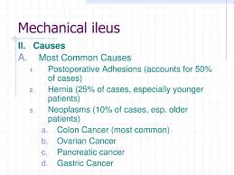 Ppt Ileus Powerpoint Presentation Free Download Id 2917456