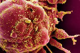 Kendati begitu, peneliti masih memerlukan penelitian lebih lanjut soal gejala baru yang timbul akibat varian virus corona b117. Seperti Apa Gejala Virus Corona Varian B117