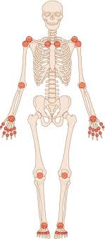 One could argue, perhaps that, in terms of human capabilities, the hands are of paramount importance but. Inflammatory Arthritides Springerlink