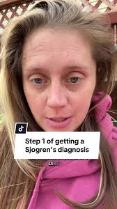 Sjogren's Diagnosis: First Steps to Take