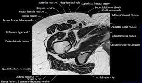 Anterior graphic of the shoulder. Mri Anatomy Of Hip Joint Free Mri Axial Hip Anatomy Hip Anatomy Pelvis Anatomy Anatomy