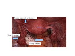 However, the same basic principle of understanding the relationship between important. Pelvic Anatomy From The Laparoscopic Perspective Ppt Video Online Download