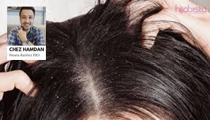 .kulit kepala manakala conditioner berfungsi untuk melembutkan , melindungi & merawat rambut bagi #summerluv yang mengalami masaalah kelemumur, berikut adalah cara untuk menghilangkan kelemumur. Bajet Tak Sampai Rm30 Penata Rambut Pro Ini Dedah Rahsia Tip 99 9 Hilangkan Kelemumur Hijabista