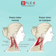 Penjelasan peta tangan kanan dan tangan kiri dalam pembuatan suatu produk. Testimoni Flex Urat Tersepit Berbulan Bulan Hilang Fokus Bekerja Flexphysiotherapy