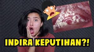 We did not find results for: Apa Penyebab Keputihan Indira Kalistha Youtube