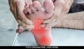 Punca sakit tumit biasanya disebabkan oleh plantar fasciitis iaitu satu keadaan yang dipanggil sebagai sindrom bonjolan tulang (heel spur syndrome). Sakit Tumit Kaki Cuba Amalkan Petua Orang Lama Ini