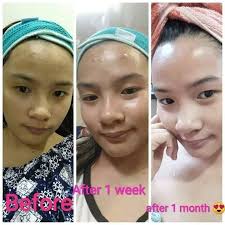 Skinny Cosmix Philippines