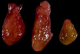 19 natural treatments + healthy diet & lifestyle changes. Pathology Of Nasal Polyps Springerlink