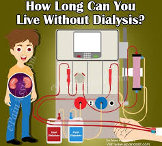 How Long Can You Live Without Dialysis Dialysis Dialysis Nurse Dialysis Procedure