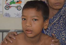 Rotaplast Missions: 2014 Sylhet, Bangladesh