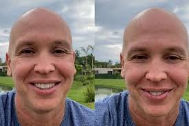 Caio Ribeiro anuncia fim do tratamento contra o câncer: "Sucesso absoluto"