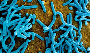 Marburg haemorrhagic fever was initially detected in 1967 after simultaneous outbreaks in marburg, from which the disease takes its name, and frankfurt in germany; Db1tu0wdvgcanm