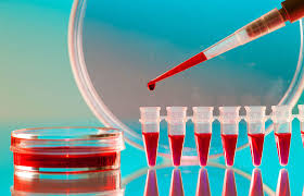 Das diagnostische zeitfenster ist die zeitspanne. Hiv Test Kosten Schnelltest Pcr Test Minimed At