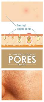 Our skin is one way the body eliminates toxins so it's important to keep pores clear and open. How To Get Rid Of Open Pores 10 Practical Home Remedies Reduce Pores On Face Face Pores How To Reduce Pores On Face