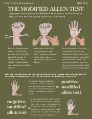 Image result for Allen Test