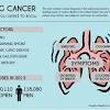 This pressure causes some of the signs and symptoms of cancer. 1