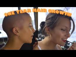 It's been a long journey.hope you all enjoy this timeline! 1 Year Hair Growth Timelapse 2019 Bald Female Youtube