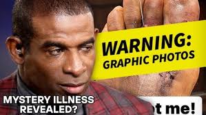 The Friendship Of Gophers' Rodney Smith & Jonathan Celestin