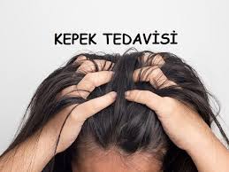 Kepekten Kurtulmak Icin Dogal Ve Etkili Yontemler Kepek Dogal Tedaviler Dogal